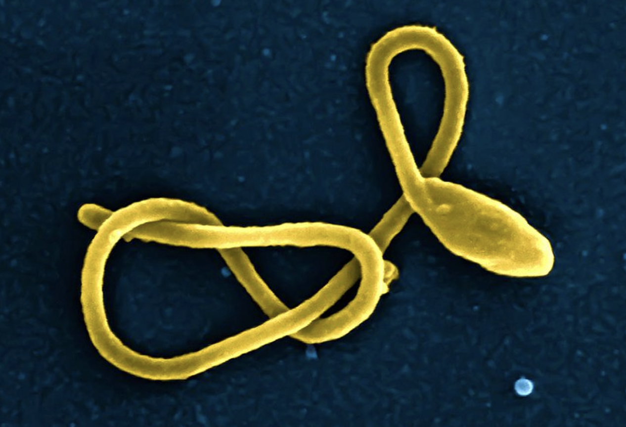 WHO Declares Health Emergency Due to Ebola Outbreak in DRC, Uganda