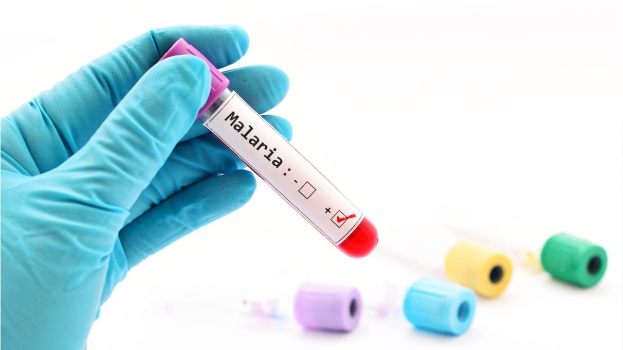 Тест на антинуклеарные антитела. Ana тест. Ana-test. Anti nuclear factor. Ana профиль кровь.