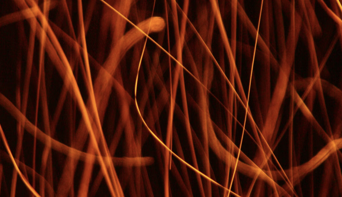 Genetic Study of Fibromyalgia Reveals a Surprising Link to Huntington's