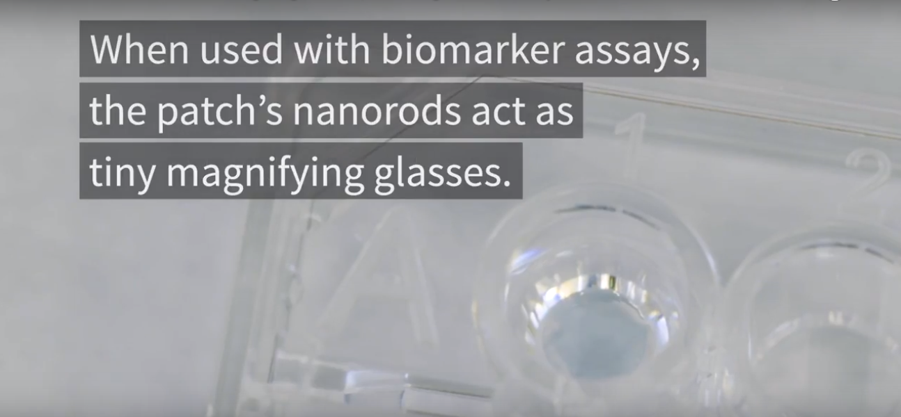 Nanotech patch makes lightup medical tests 100x brighter Clinical And Molecular Dx