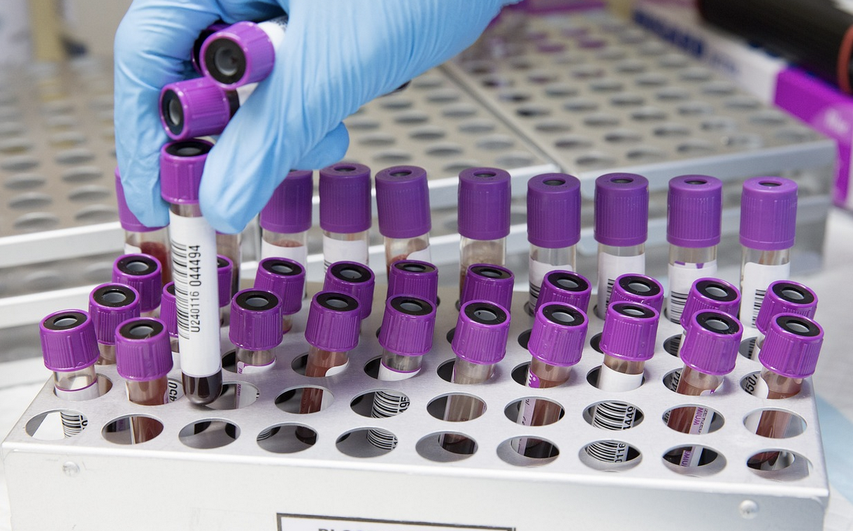 Three Pneumonia Subtypes are Discovered