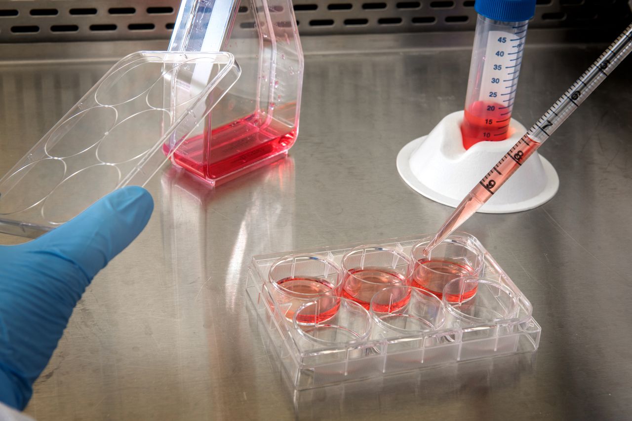 Dynamic UTI model transforms bacterial behavior