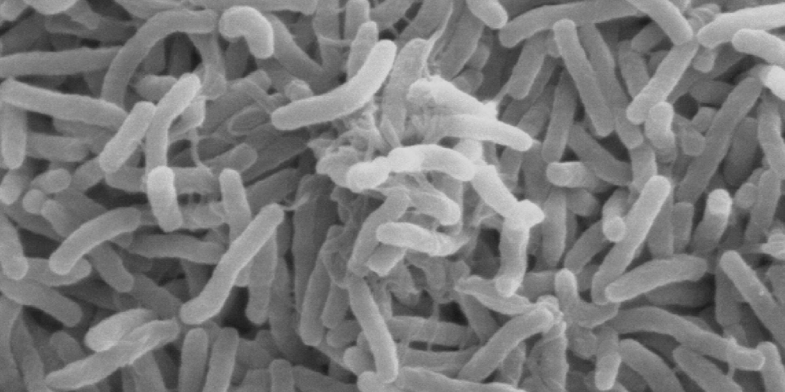 Colon Cancer Screening Via Gut Bacteria? | Clinical And Molecular Dx