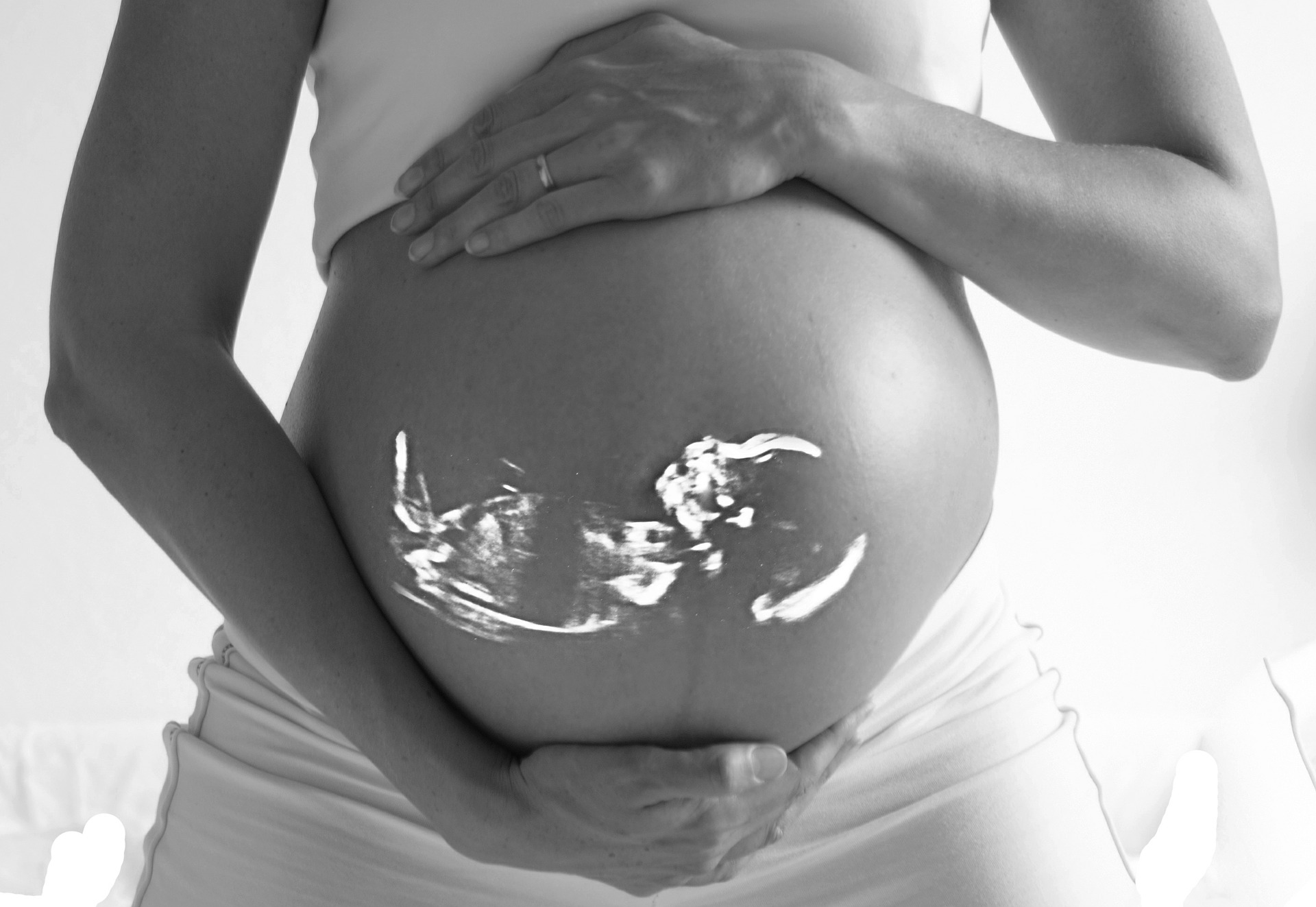 The Link Between Fetal Cannabis Exposure and Obesity - Vimarsana News