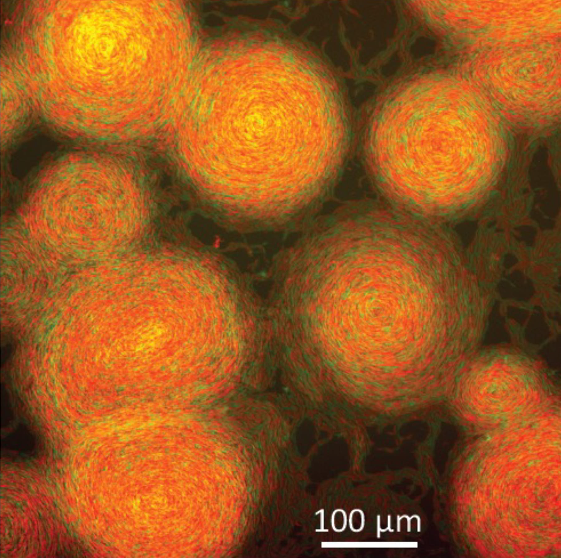 A Genetic Modification Alters Bacterial Behavior to Produce Artistic Swirls - Vimarsana News