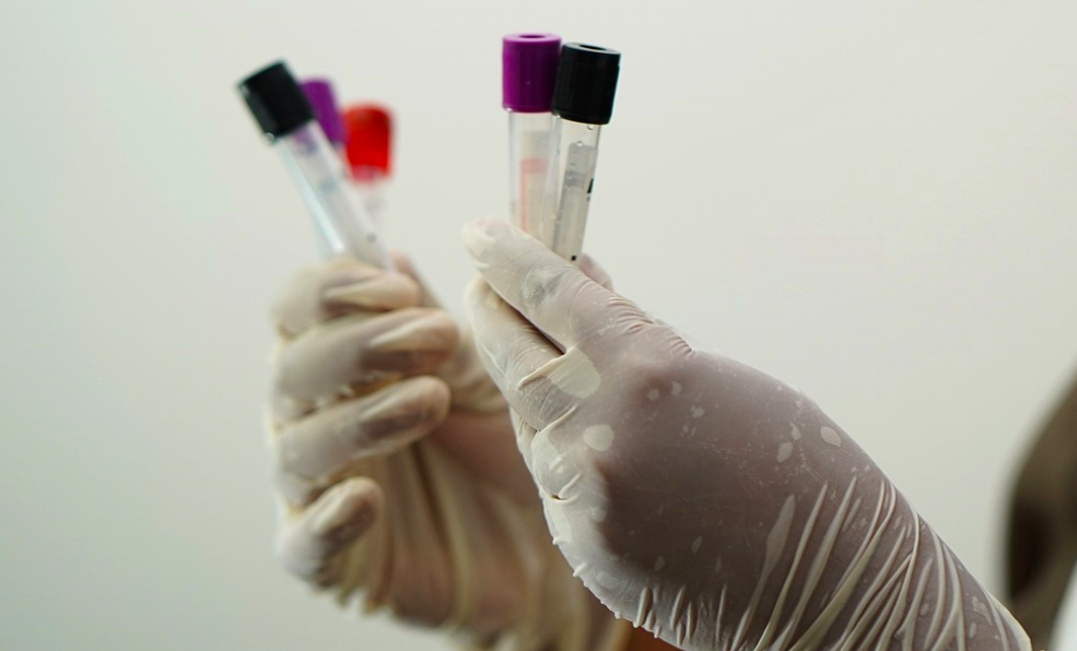 The First Alzheimer's Blood Test is Now FDA Approved | Clinical And ...