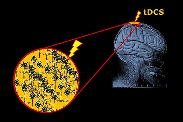 DIY Brain Zapping Is A Bad Idea | Neuroscience