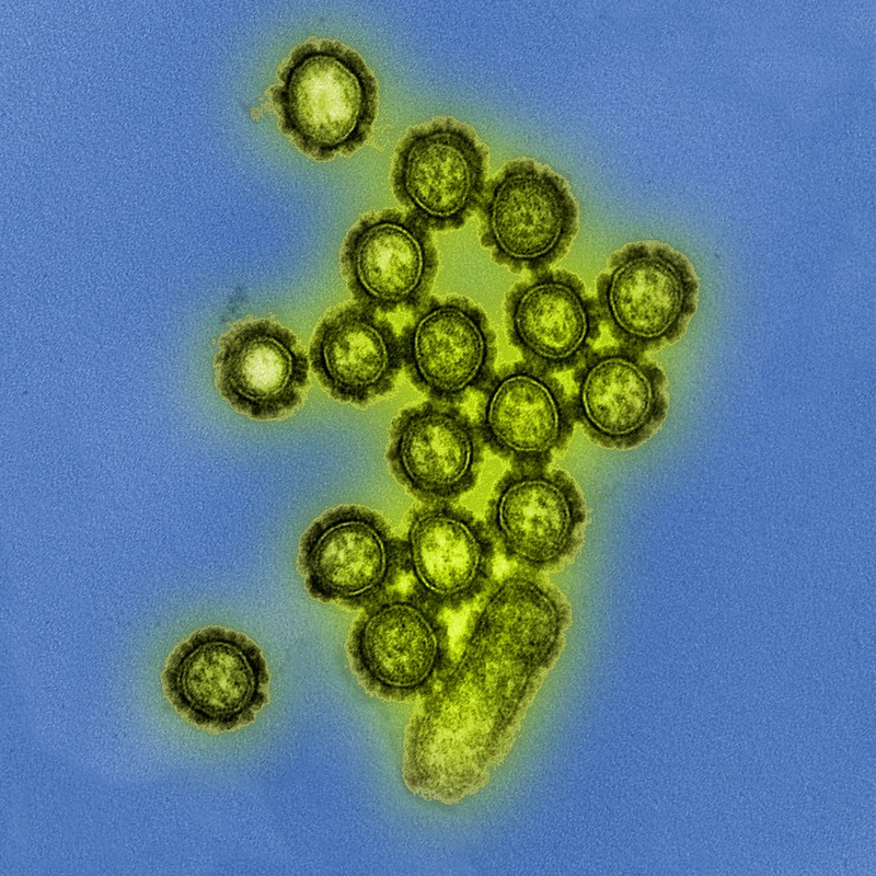 Watching the Influenza Virus as it Sneaks Into Cells | Cell And ...