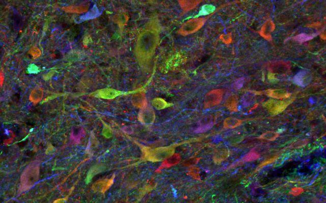 Successful Neural Stem Cell Therapy Without Immunosuppression ...