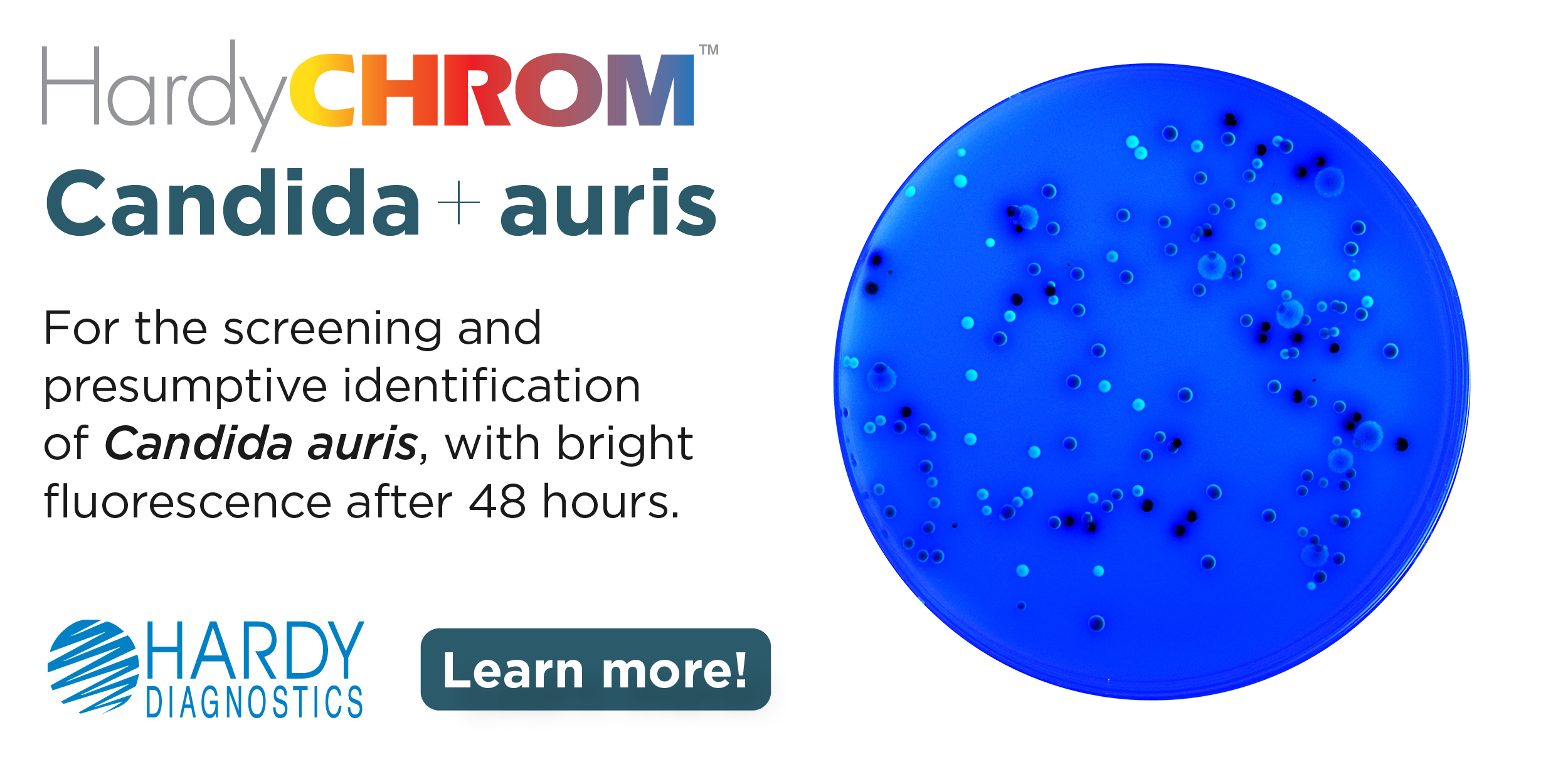 Is it panresistant Candida auris? Now you can know for sure Microbiology