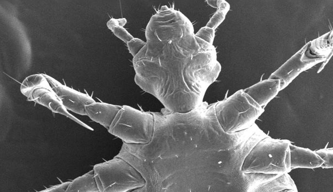 Human or Host? Parasites in Human History & Prehistory - Vimarsana News
