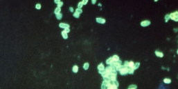 Better Know a Microbe Aliivibrio fischeri