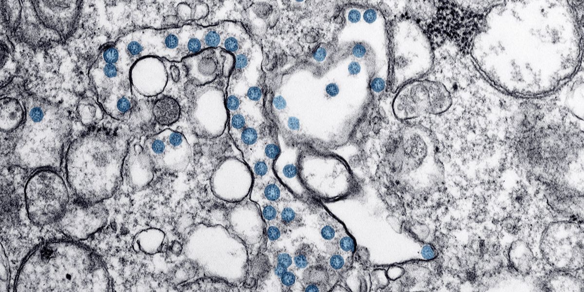 WHO Begins Trial for Ebola Outbreak