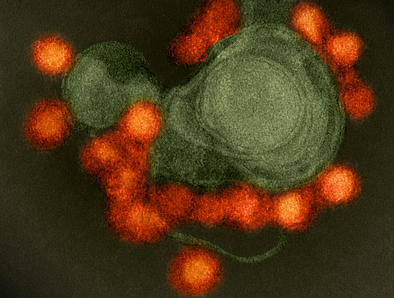 Previous Zika Infections Increase the Risk of Severe Dengue - Vimarsana News