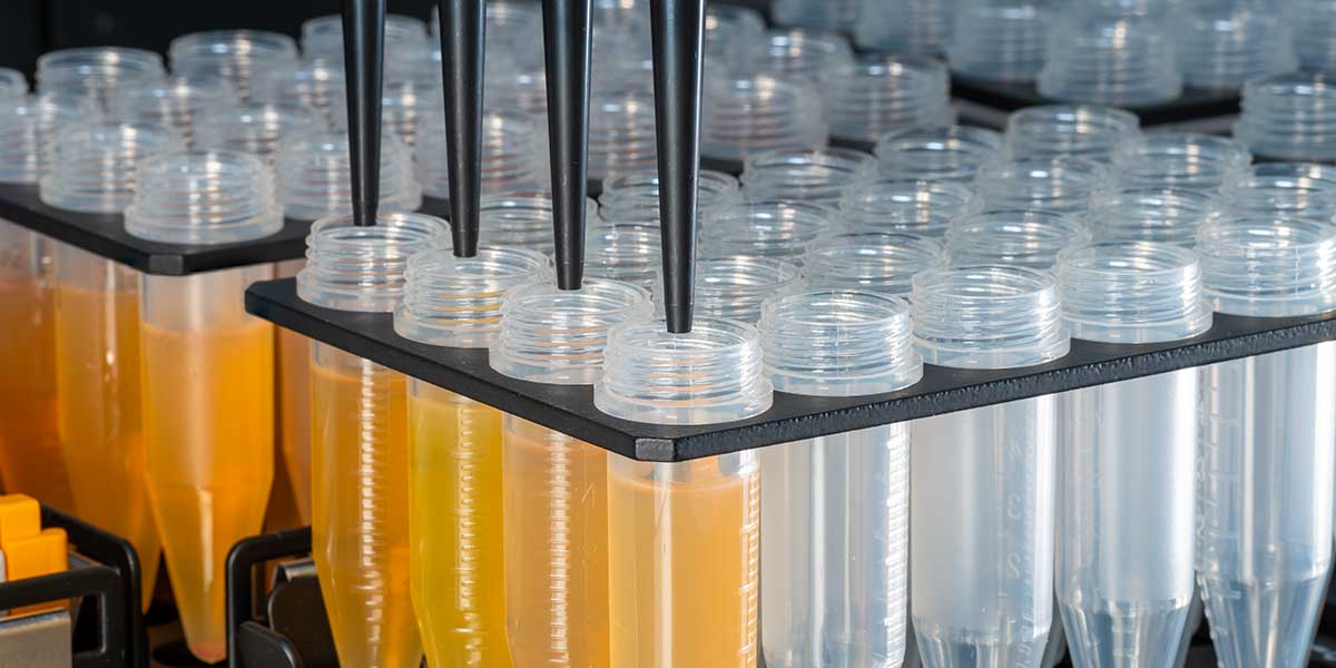 Tips on Establishing a Reliable Cell Free DNA Workflow | Genetics And ...