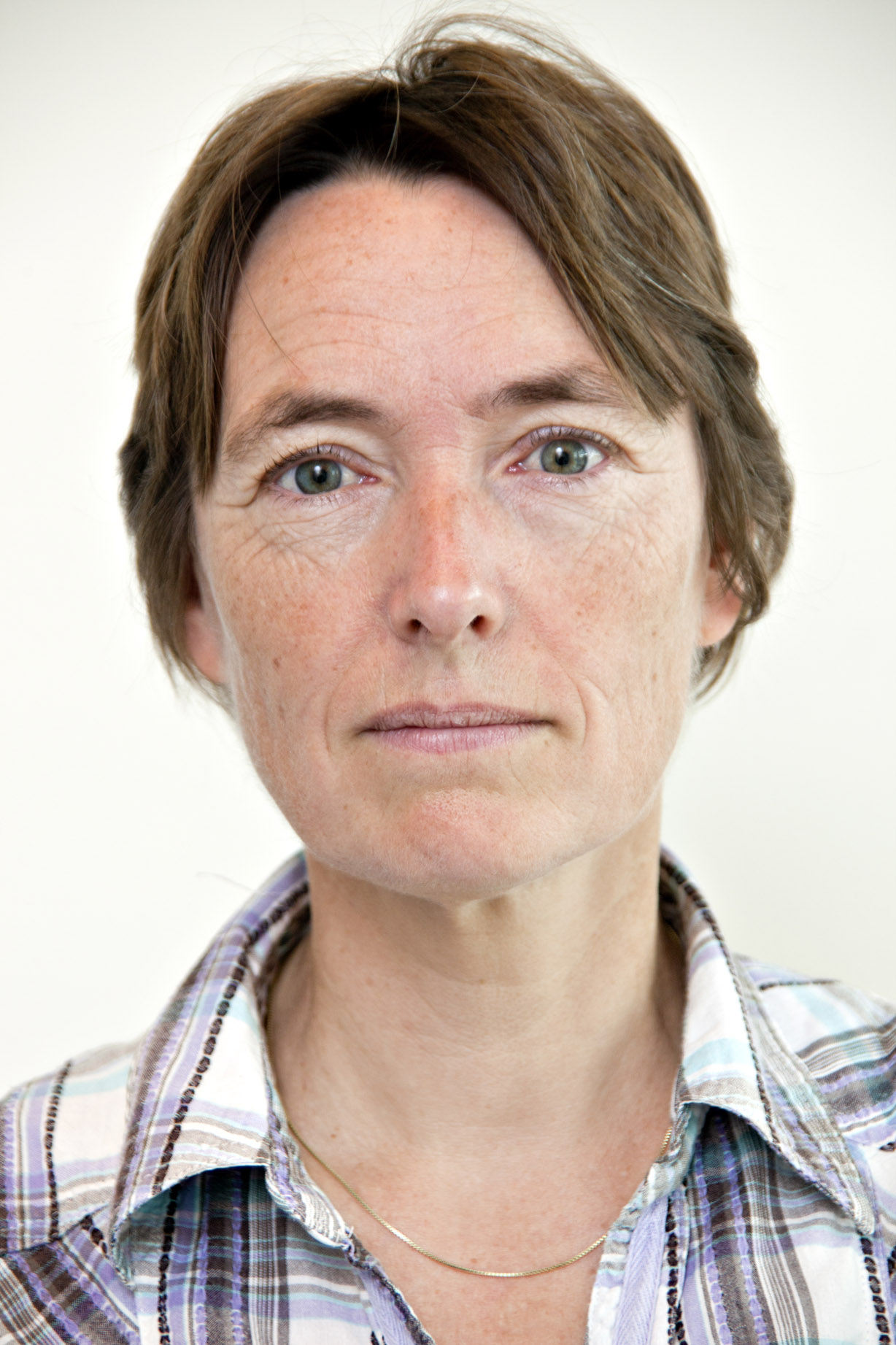 Transition Acute to Chronic Pain Post Surgery