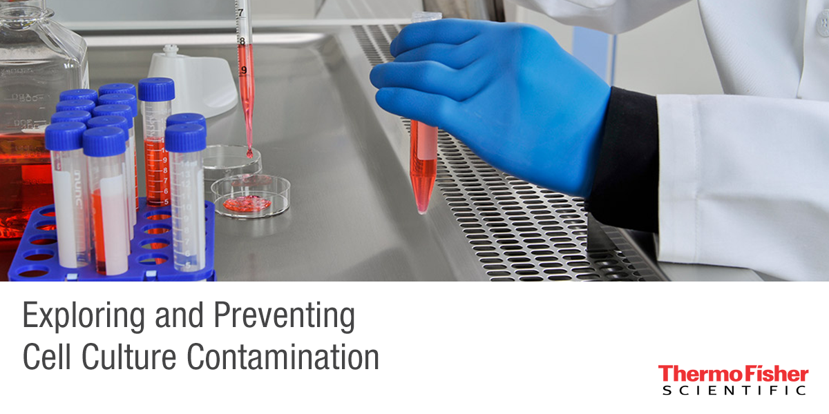 Exploring and Preventing Cell Culture Contamination