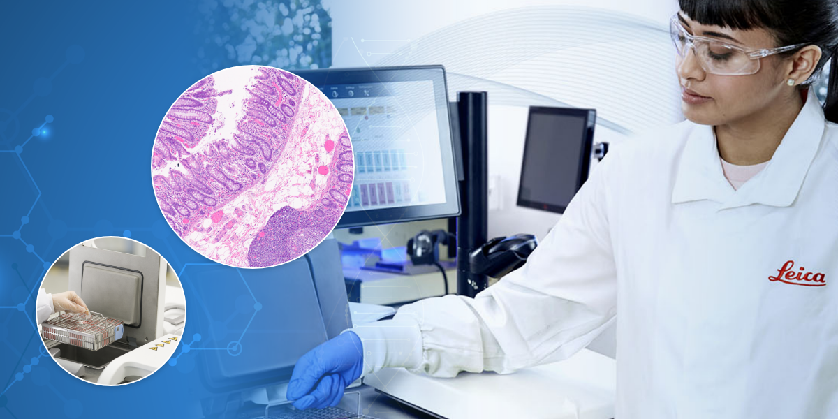 Lessons From The Laboratory: Your Tissue Processing Questions, Answered