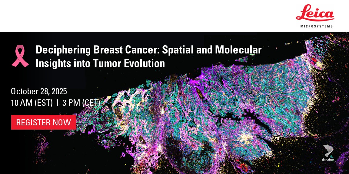 Deciphering Breast Cancer: Spatial and Molecular Insights into Tumor ...