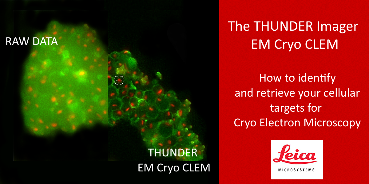 The THUNDER Imager EM Cryo CLEM How to identify and retrieve your cellular targets for Cryo