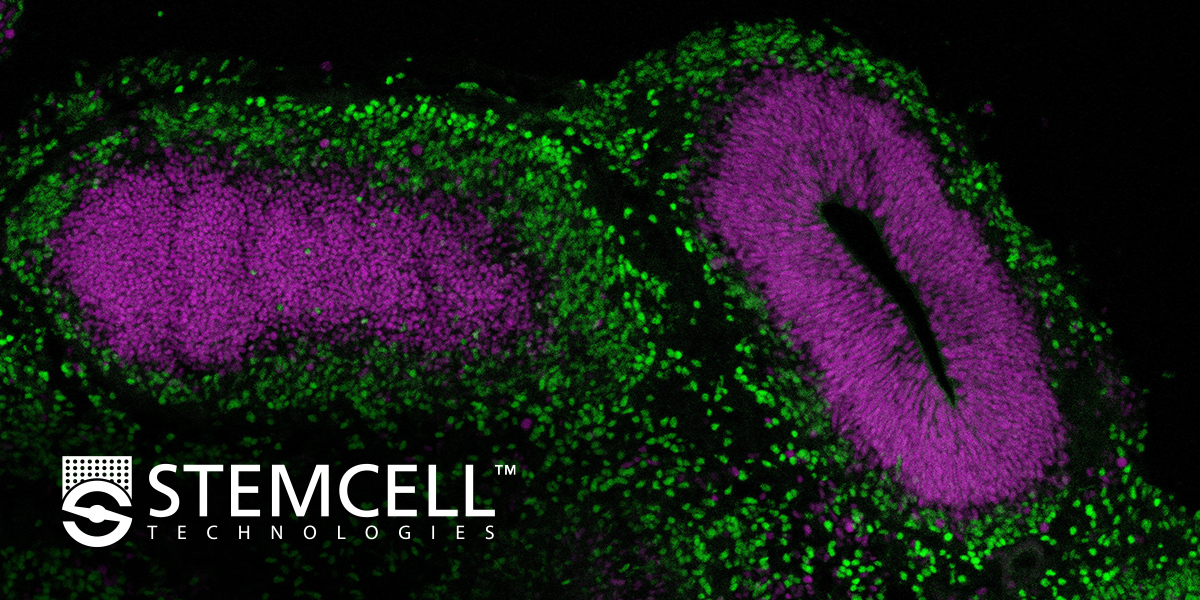 Modeling the human brain using induced pluripotent stem cells (iPSCs)