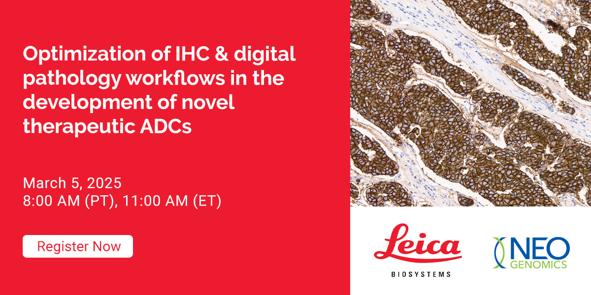 Optimization of IHC & digital pathology workflows in the development of ...