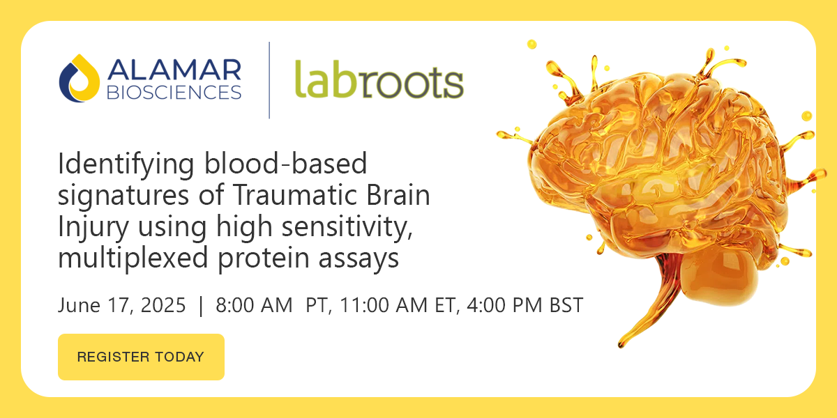 Identifying blood-based signatures of Traumatic Brain Injury using high ...